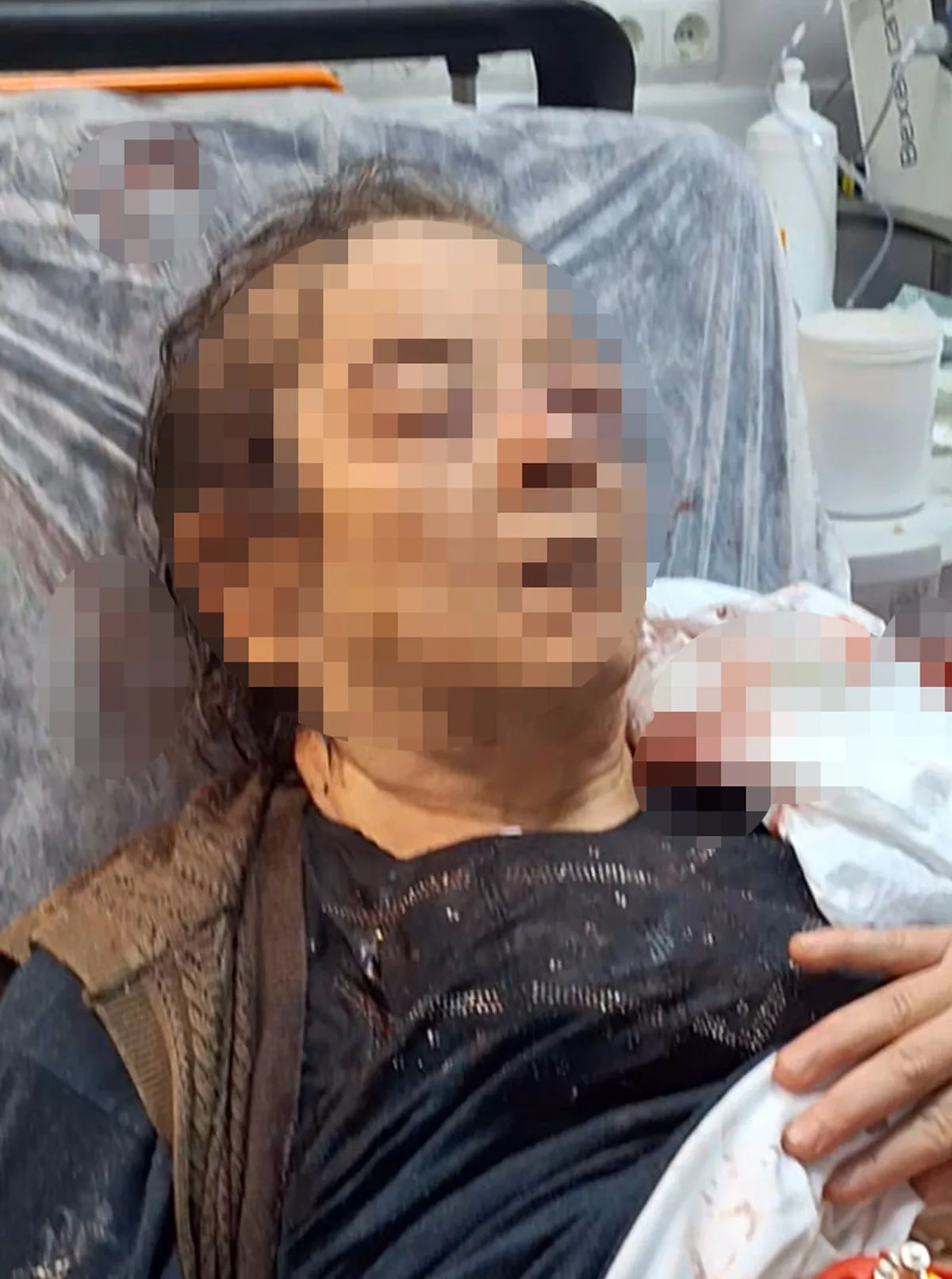 Kayseri Melikgazi'de tavandan kopan moloz altında kalan 75 yaşındaki F.Ö. yaralandı