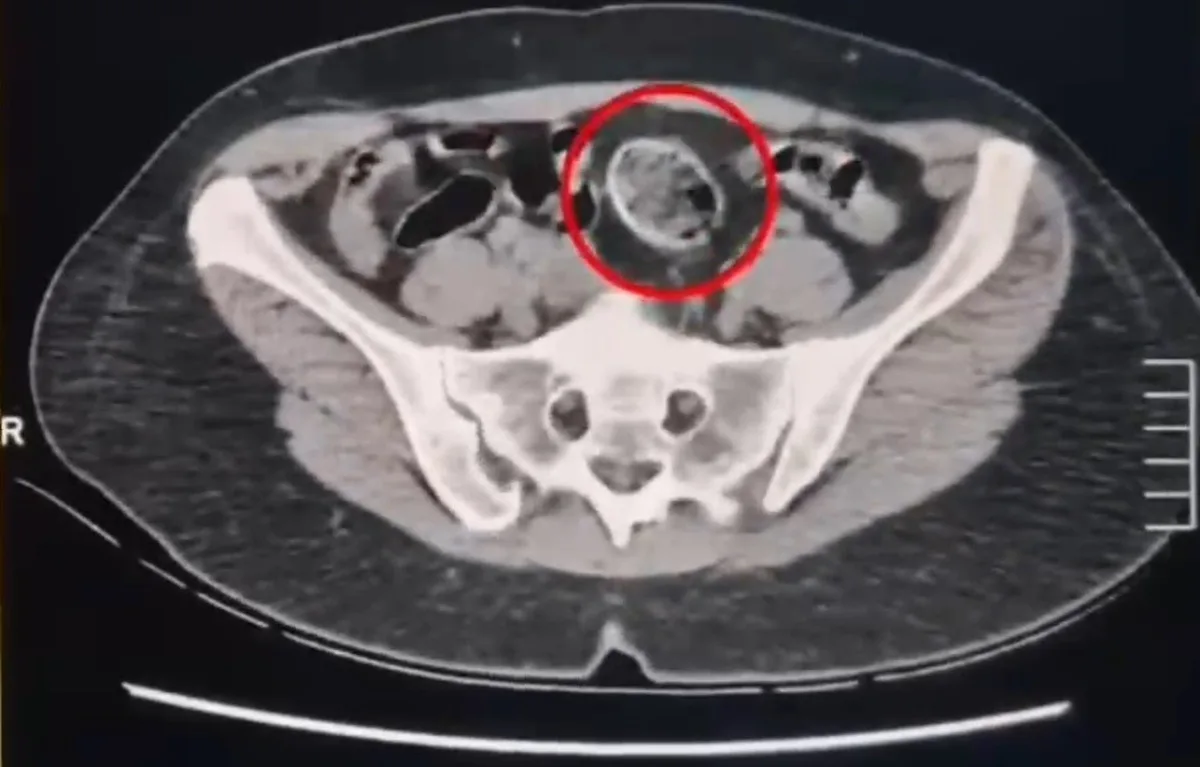Kars'ta İran uyruklu 2 şüpheli, vücutlarında 307,94 gram metamfetaminle tutuklandı