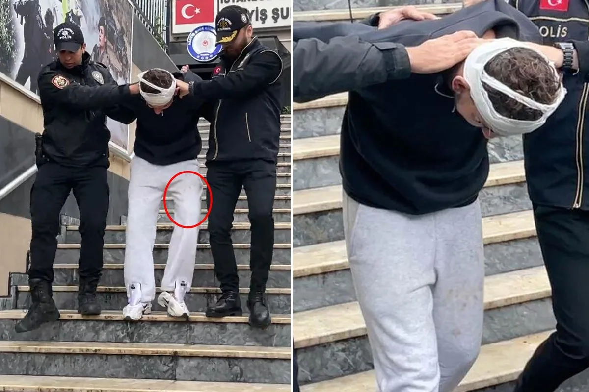 4 milyon doları vurdu, estetik masasında yakalandı!