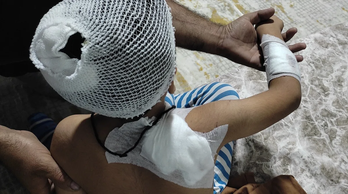 Şanlıurfa Viranşehir'de sahipsiz köpek saldırısından yaralanan çocuk taburcu edildi